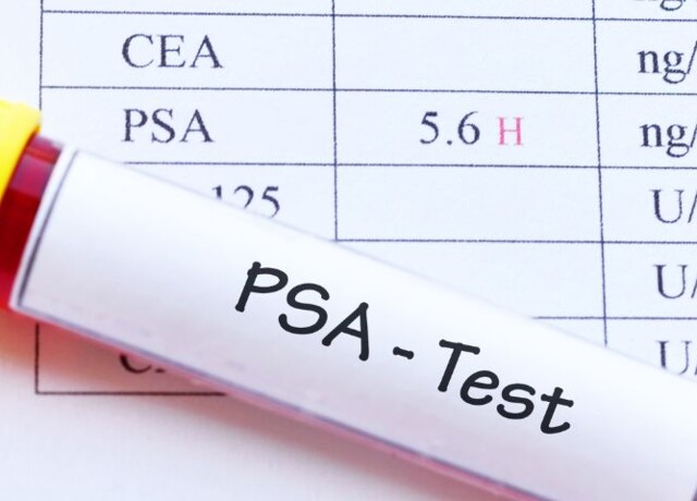 20/06 - Prevenzione prostata (misurazione PSA)